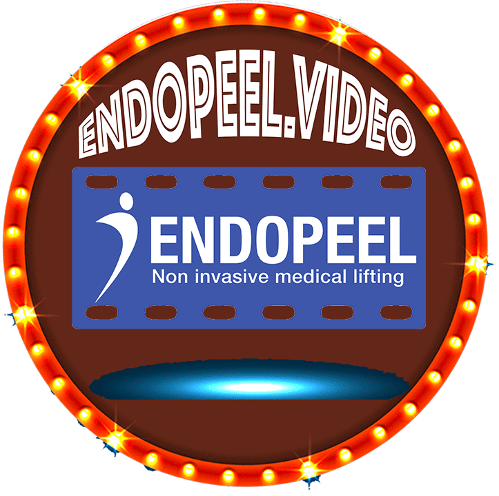 new-endopeel-video-logo